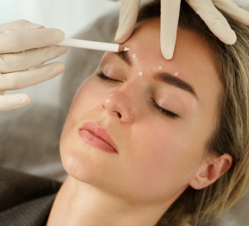 botox-4
