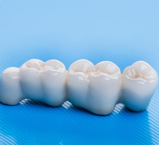 missing-teeth-2