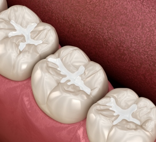preventive-dentistry-4